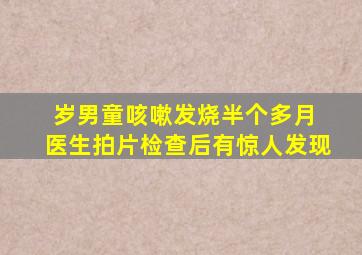 岁男童咳嗽发烧半个多月 医生拍片检查后有惊人发现